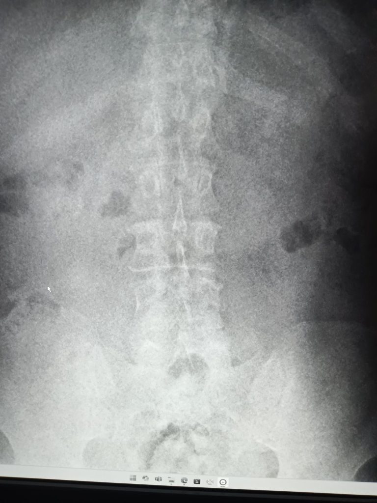 “撮る”ことから始まる医療支援──放射線の現場、パラオで奮闘中 3 IMG 20250512 153747