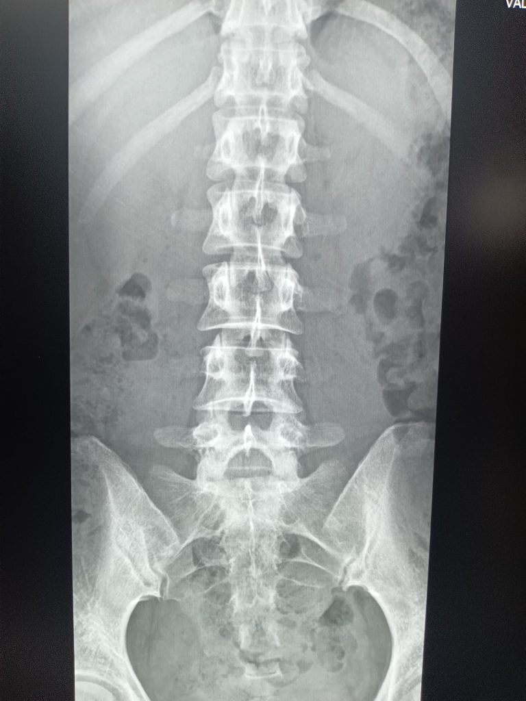 “撮る”ことから始まる医療支援──放射線の現場、パラオで奮闘中 4 IMG 20250512 154204